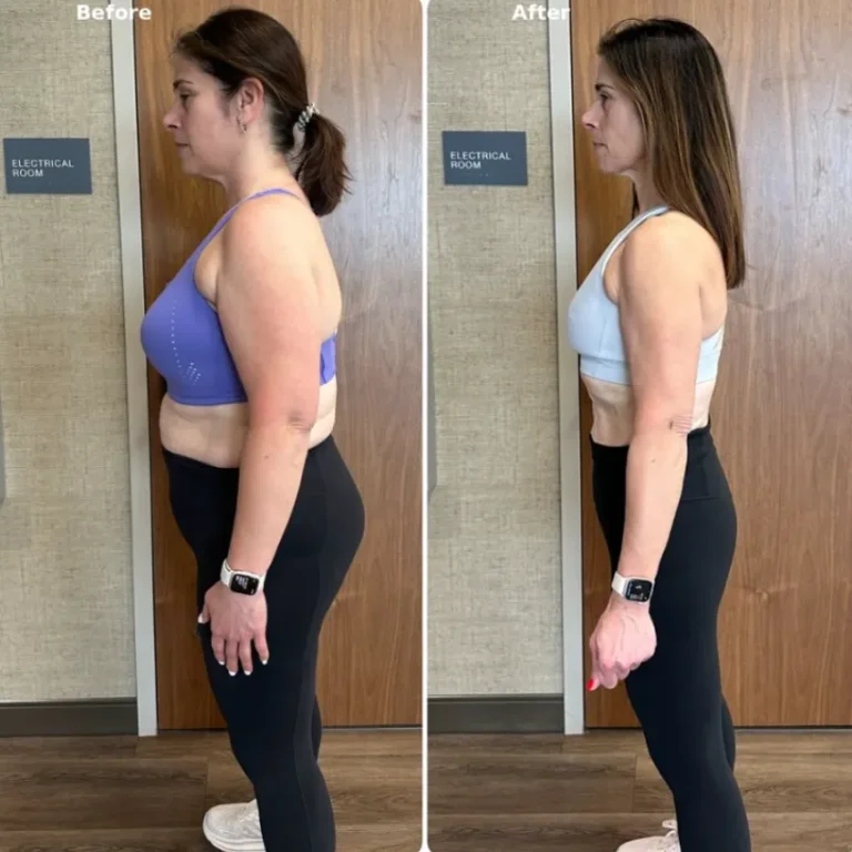 noticeable weight loss in female client